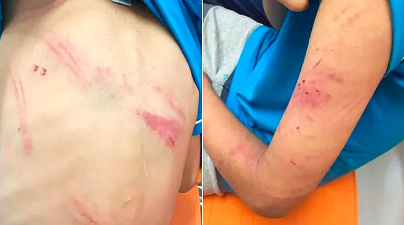 Mãe é suspeita de espancar o filho após ele furtar bolacha por estar com fome em São Carlos