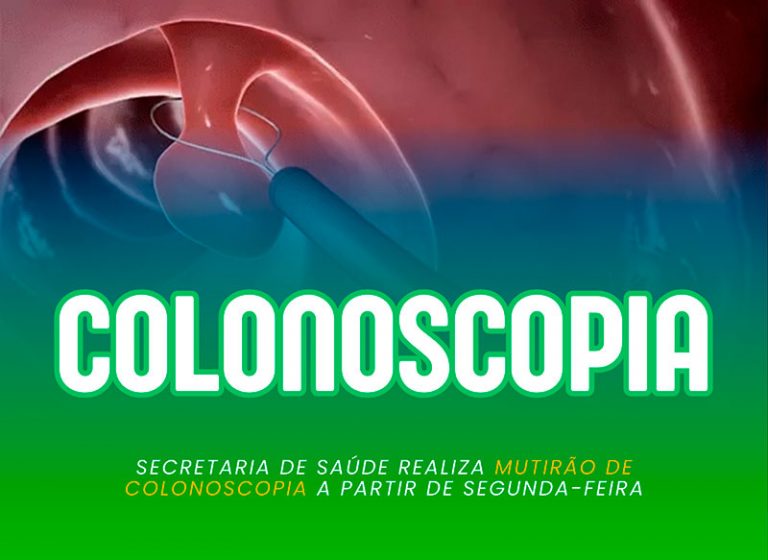 Secretaria de Saúde realiza mutirão de colonoscopia a partir de segunda-feira